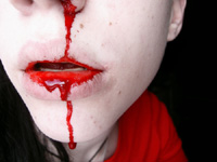 20100330_nosebleed_by_chickiprick